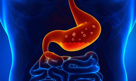 Gastritis .